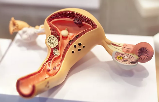 Uterus Model